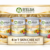 5-in-1 Skin Brightening Face Pack Combo for Acne & Dark Spots